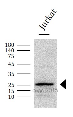 Вестерн-блоттинг: 30 мкг лизата клеток Jurkat, окрашенного антителами anti-Bcl 2 antibody в разведении 1:1000.