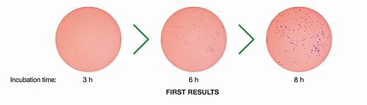 Станция автоматического инкубирования, размер колоний от 0,05 мм, со встроенным инкубатором, в режиме реального времени, ScanStation 200 Фото 2