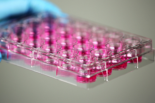 Бортик и наполнение культурального планшета