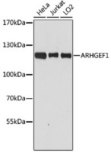 Антитела [KO Validated] ARHGEF1 кроличьи, поликлональные