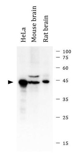 Вестерн-блоттинг: 10 мкг клеточной линии HeLa, 20 мкг лизата мозга мыши и 20 мкг лизата мозга крысы, окрашенные антителами anti-Caspase 9 antibody в разведении 1:1000.
